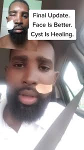 Lessons Learned: MRSA Infection and Allergies