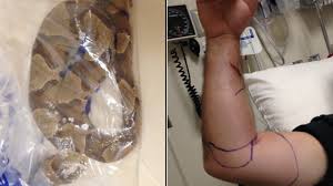 Man recovering after bit by copperhead at Denver Lowe's