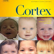 PDF) Non-verbal communication in severe aphasia: Influence of aphasia,  apraxia, or semantic processing?