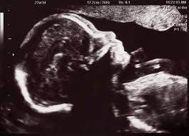 4d ultraschall in der 28.woche. Dopplersonographie Doppler Ultraschall In Der Schwangerschaft 9monate De