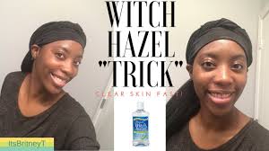 Witch hazel cannot only help control blemishes, but it can also keep your skin smooth and supple as well. Witch Hazel 7 Days For Acne Dark Spots Youtube