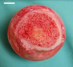 Cartilaginous area at the ends of long bones where lengthwise growth takes place in the immature skeleton. 6 3c Microscopic Anatomy Of Bone Medicine Libretexts