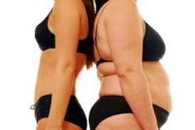 Affordable Bariatric Weight Loss Surgery Abroad For Nhs Patients