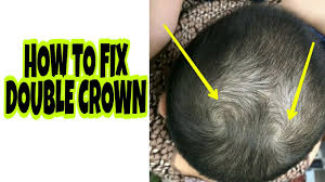 The cutest crown braid hairstyles for fun summer days. 360 Waves How To Fix Double Swirl Crown What You Need To Know Youtube