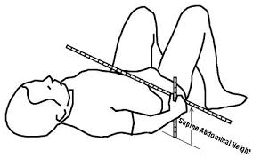 Sagittal Abdominal Diameter Wikipedia