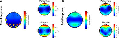 If you or someone you love is struggling with the use of psychedelic mushrooms, there is help available in the form of personalized addiction. Frontiers The Effects Of Daytime Psilocybin Administration On Sleep Implications For Antidepressant Action Pharmacology