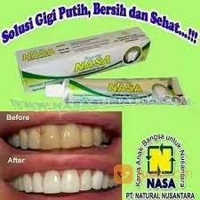 Manfaaat Pasta Gigi Nasa Pasta Gigi Nasa Memberikan Manfaat Besar Bagi Kita Semua Terutama Untuk Ke Malang Jualo