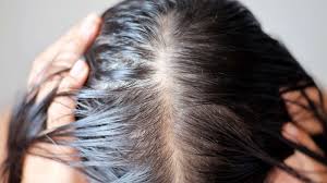 If you believe you may be. 12 Signs Of Hair Loss To Bring Up To Your Dermatologist Gma