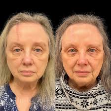 Robb Facial Plastic Surgery...