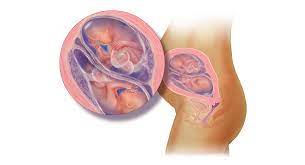 Zwillingsentwicklung 20 Wochen Schwanger Babycenter