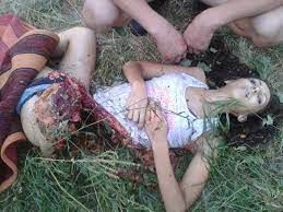 This is the default web page for this server. 19yo Girl Killed By A Bomb In Ukraine