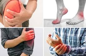 Các bệnh về xương khớp thường gặp và triệu chứng của bệnh