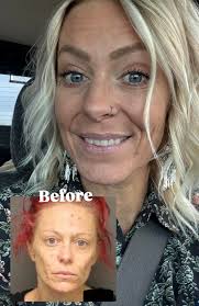 Dear Me 6 years ago, I know you're scared right now. You probably feel like  you're standing at the bottom of a dark well with no way out — broken,  ashamed, exhausted,