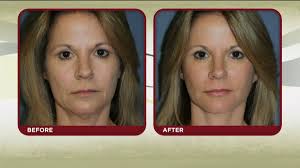 Smith Cosmetic Surgery Facial Plastic Surgery And Skin Care In Denver Https Kdvr Com 2018 06 29 Smit Facial Plastic Surgery Cosmetic Surgery Facial Plastic