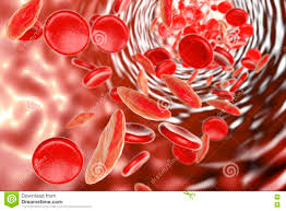 Sickle cell anemia) ist eine erbliche erkrankung der roten blutkörperchen (erythrozyten). Sichelzellanamie Stock Abbildung Illustration Von Storung 79155794
