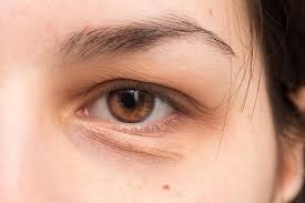 Get motivation for the best journey towards youthful and fresh complexion here! How To Get Rid Of Eye Bags An Expert S Guide