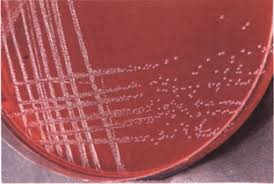 Image result for Group D Streptococcus