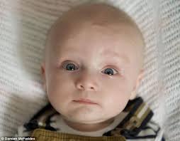 Becomes mother after pioneering cervical cancer surgery