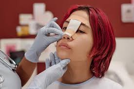 Cómo limpiar mi nariz después de una rinoplastia? ¡Le contamos!