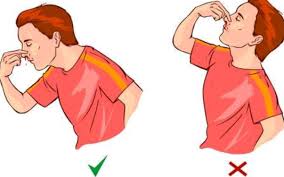 Izinkan kami kongsi, sekali dengan cara merawat hidung berdarah & hentingkan pendarahan hidung. Mendongak Bila Hidung Berdarah Adalah Salah Ni 7 Step Patut Buat Bila Hidung Berdarah Dah Tau Ker