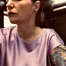 Surgery is over. Time to recover with the Plan to train with excitement  about get stronger, faster, and overall fitter. I want to train everyday by  doing things I love while also