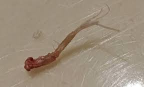 Hirsutism can be seen as coarse, dark hair that may appear on the face, chest, abdomen, back, upper arms, or upper legs. What Is This Thing I Pulled Out Of My Beard Whatisthisthing