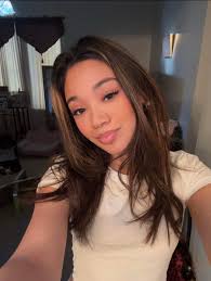 Jade is doing so well. We just love her . Day 3