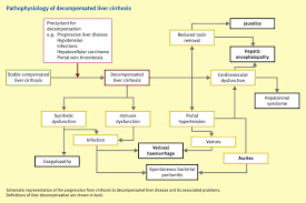 Decompensated Liver Cirrhosis Sciencedirect