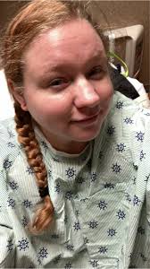 Gastric Sleeve Surgery Support and Experience