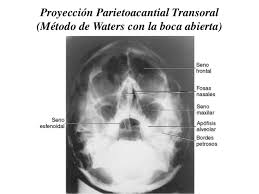 / descargar libros gratis en formatos pdf y epub. Bontrager Posiciones Radiologicas Y Correlacion Anatomica Pdf Kitsdwnload