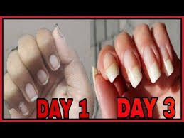 How To Grow Nails Fast Malayalam Finger Nail Grow Fast Simplymystyle Youtube In 2020 Grow Nails Faster How To Grow Nails Fingernails