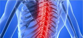 Los doctores dijeron que tenía amiotonía congénita y predijeron que no viviría más allá de. Spinraza El Primer Tratamiento Para La Atrofia Muscular Espinal Periodistas En Espanol