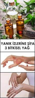 Yanik Izlerine Sifa 3 Bitkisel Yag Www Vipbakim Com Yag Cilt Beyazlatma Saglikli