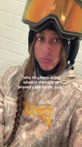 Is It Normal for My Shin to Bruise While Using A Boot