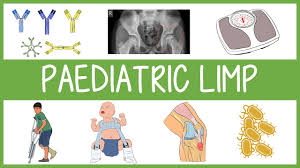 Image result for Pediatric Limp