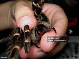 Image result for Tarantula Bite