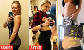 Endo belly symptoms can vary from person to person, but are often linked to endometriosis flares or the menstrual cycle. Endometriosis Sufferers Share Photos Of Their Severely Bloated Stomachs On Social Media Daily Mail Online