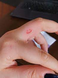 Pin By Virag On Tattoos Smiley Face Tattoo Stick N Poke Tattoo Stick Tattoo
