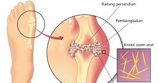 We did not find results for: Gangguan Pada Sistem Gerak Manusia Kerajaan Biologi