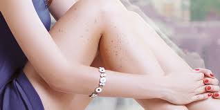 Supplement probiotics by adding to your daily diet foods such as yogurt, kefir, sauerkraut, dark chocolate, and miso soup. How To Remove Black Spots On Legs Feet And Ankles