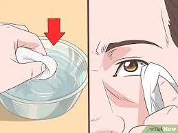 4 Ways To Get Bright White Eyes Wikihow