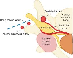 Radix nervi) is the initial segment of a nerve leaving the central nervous system.nerve roots can be classified as: Arm Annals Of Rehabilitation Medicine