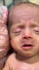 Emergency Admission of Baby Naveed with Abdominal Distension