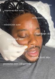 Chemical Peel in Las Vegas Black Skin