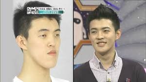 31 Crazy Before And After Photos Of Korean Plastic Surgery Korean Plastic Surgery Plastic Surgery Pictures South Korean Plastic Surgery