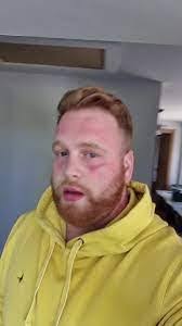 Jack Mallinder's Instagram, Twitter & Facebook