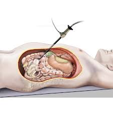 This full color custom medical exhibit features an anterior and sagittal view of the normal anatomy of the female reproductive system, an enlarged anterior view of the left fallopian tube and ovary is. Abdomen Illustrations Visualisations Of Human Anatomy