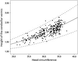 Nomograms Of Cerebellar Vermis Height And Transverse