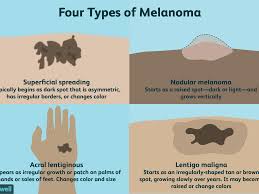 Having skin lesions known as actinic keratoses can increase your risk of developing skin cancer. Melanoma Overview And More
