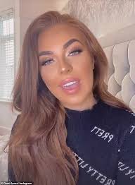 People with thyroid cancer may experience the following symptoms or signs. Love Island S Demi Jones 22 Thanks Fans For Support After Devastating Thyroid Cancer Diagnosis Daily Mail Online
